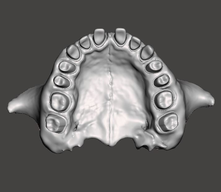 Human maxillary jaw with typodont