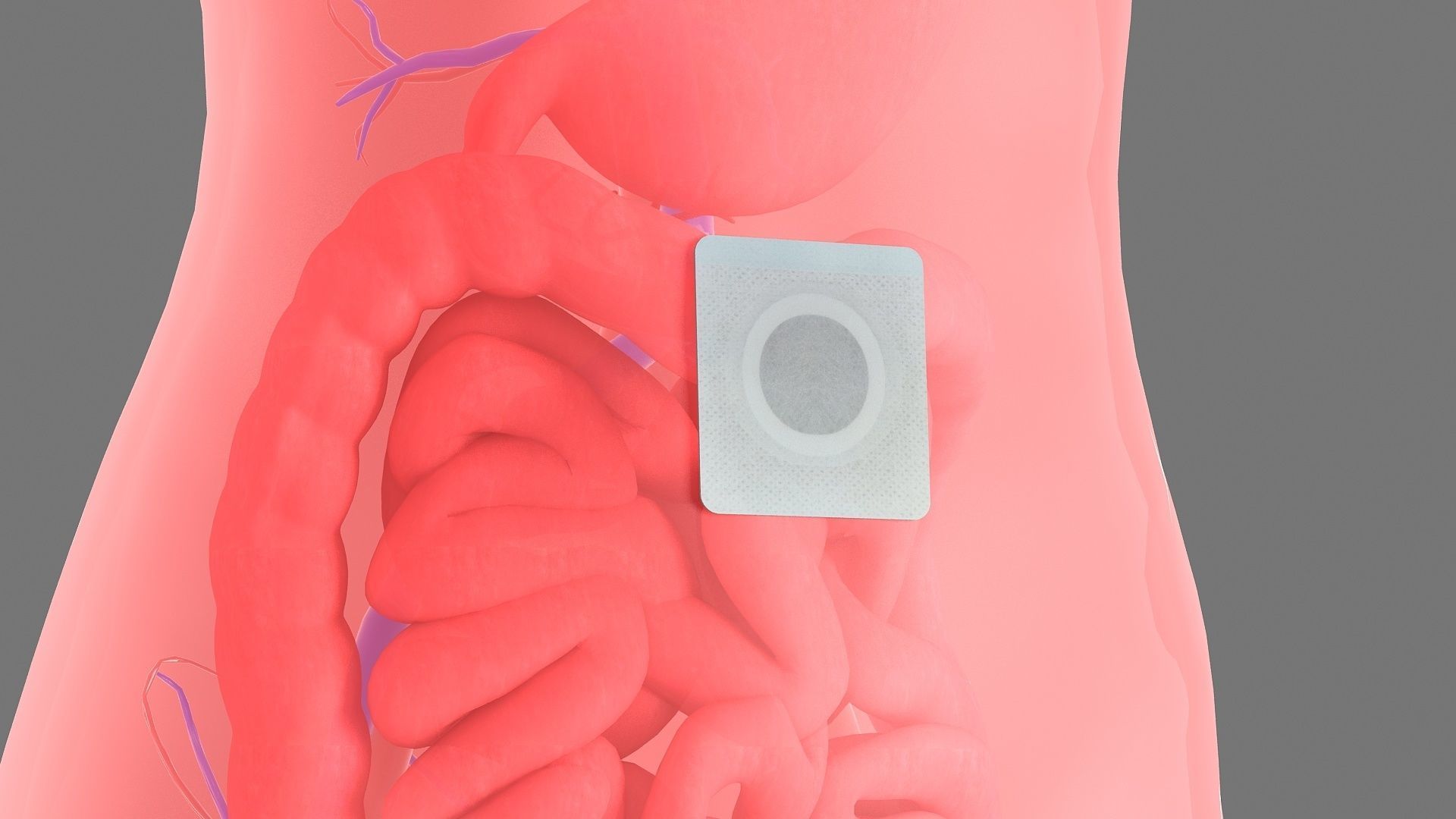 Stomach patch patch animation 3D model CGTrader