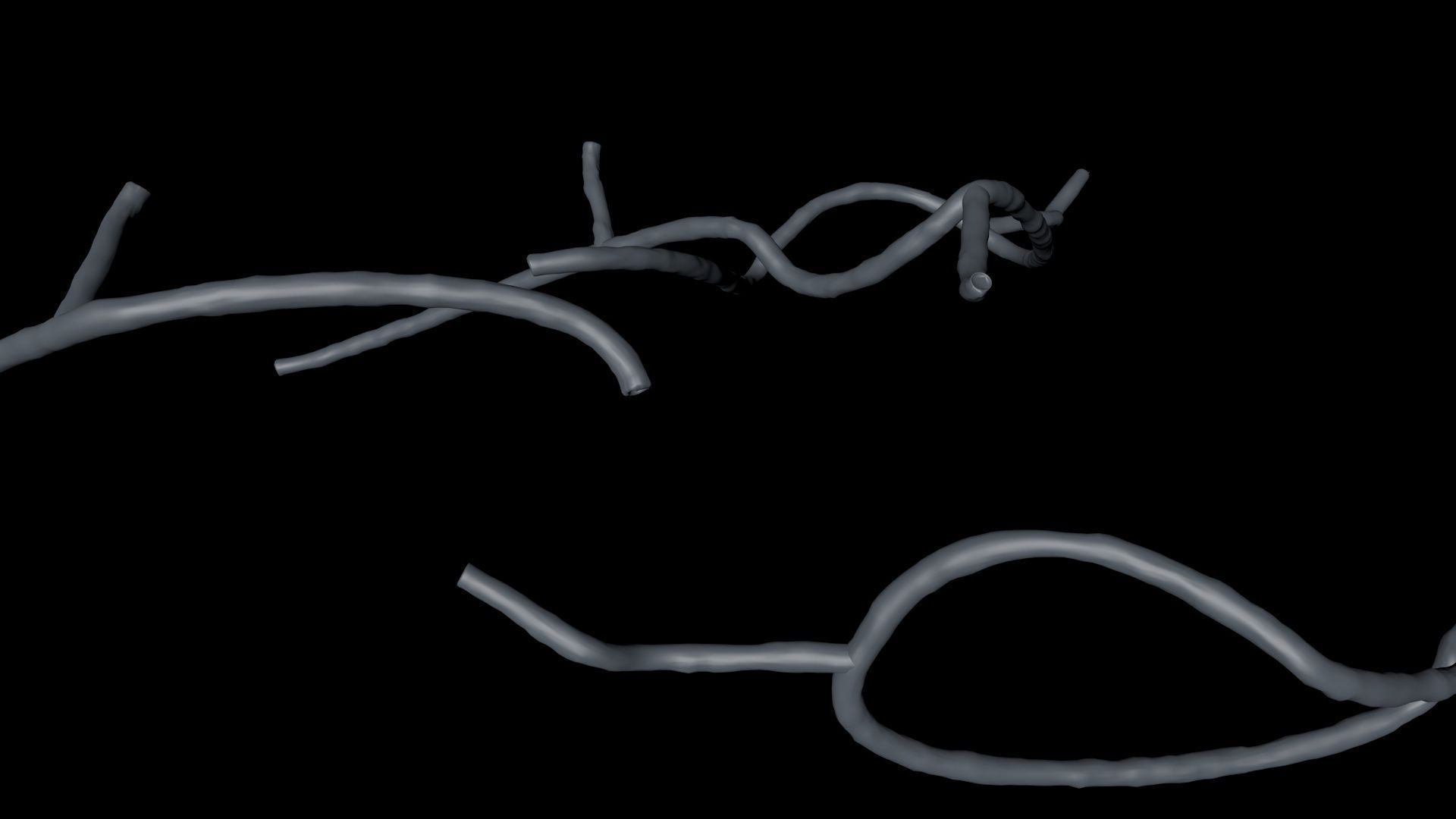 Microscopic Ebola Virus